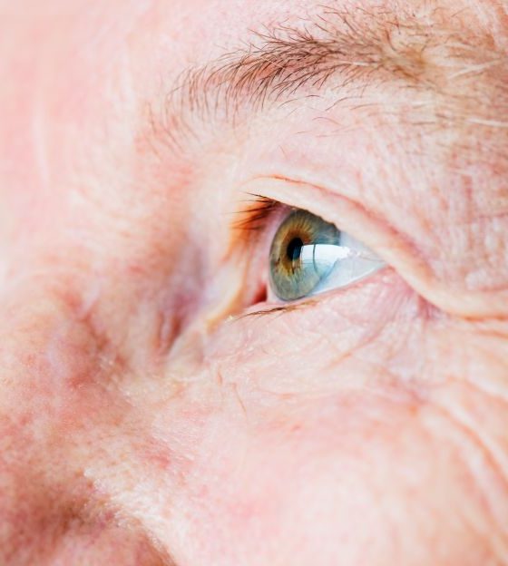 Quais os tipos de catarata