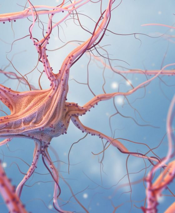 O que você precisa saber sobre doenças neurodegenerativas